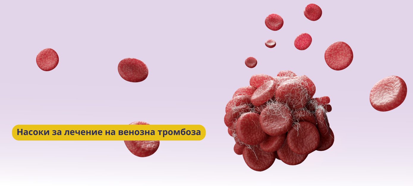 Клинична практика, Насоки за лечение на венозна тромбоза